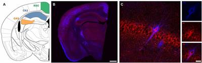 Parvalbumin Interneurons and Perineuronal Nets in the Hippocampus and Retrosplenial Cortex of Adult Male Mice After Early Social Isolation Stress and Perinatal NMDA Receptor Antagonist Treatment